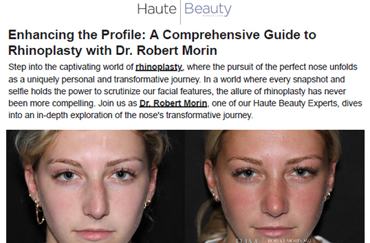 Enhancing the Profile: A Comprehensive Guide to Rhinoplasty with Dr. Robert Morin