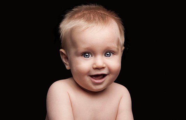 Cleft Lip Repair