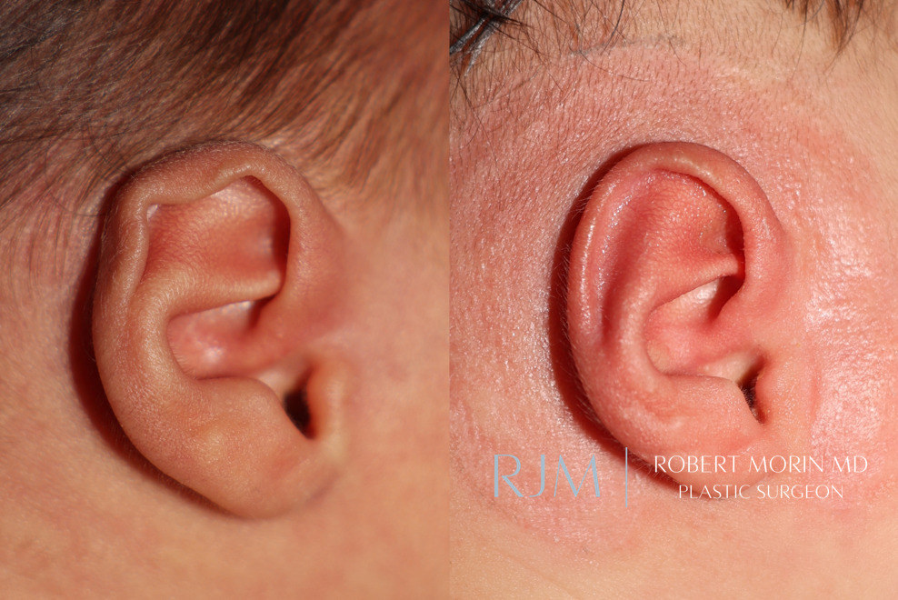  ma earwell 4